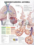 Understanding Asthma Anatomical Chart - Laminated